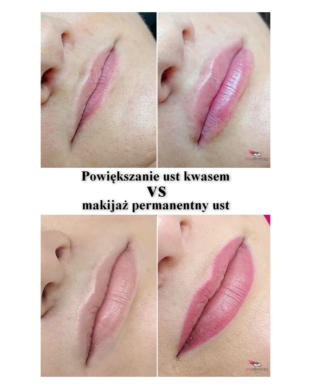 Zdjęcie Czy makijaż permanentny ust powiększa usta? Odkryj prawdę o efektach