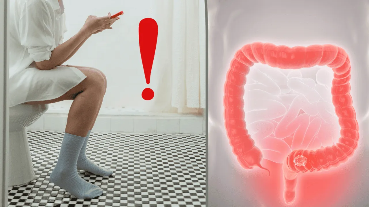 Zdjęcie Objawy raka odbytu: 8 niepokojących sygnałów, które nie mogą czekać