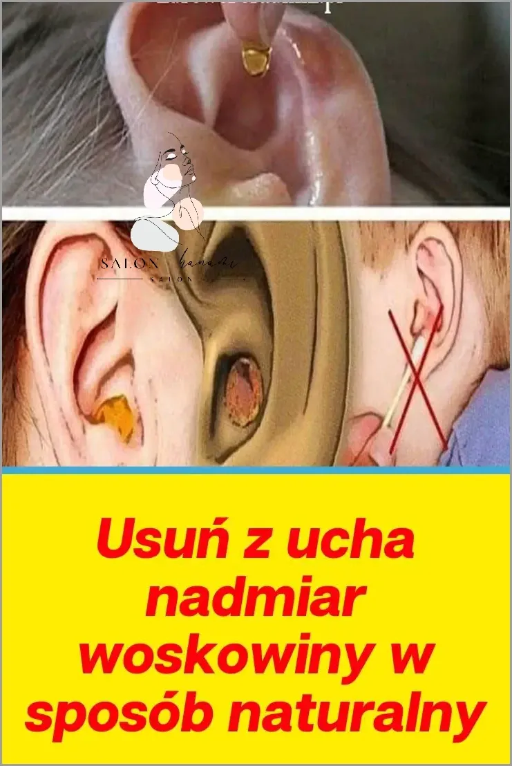 Zdjęcie Bezpieczne sposoby na usunięcie wągrów z ucha dziecka bez ryzyka