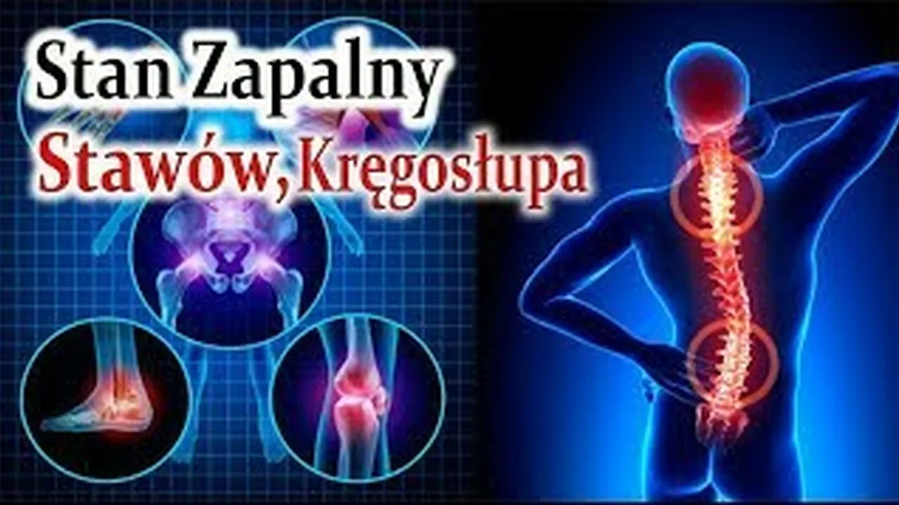 Zdjęcie Badania na zapalenie stawów: 5 kluczowych testów diagnostycznych