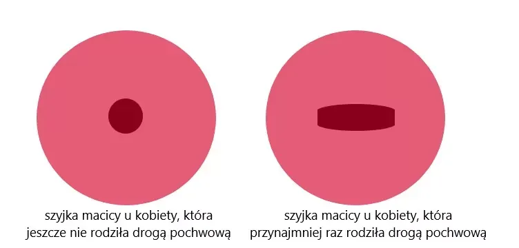 Zdjęcie Szyjka macicy 3 cm – co oznacza i kiedy rzeczywiście zaczyna się poród?