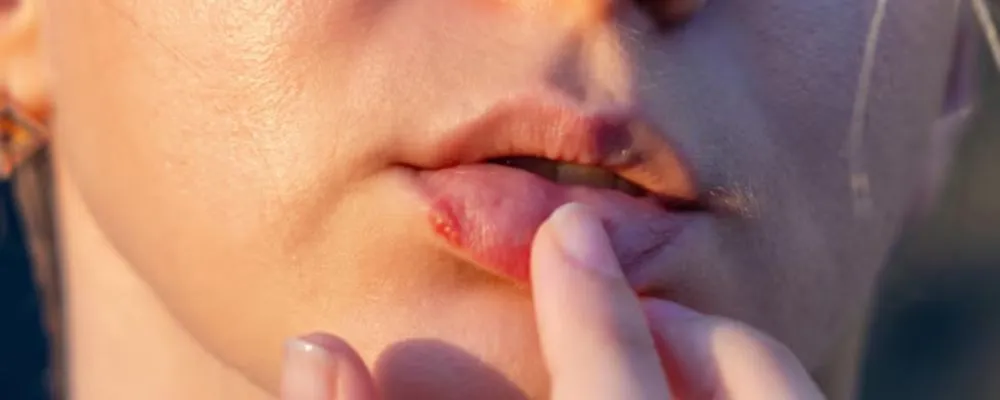 Zdjęcie Jak wygląda pryszcz pod skórą? Objawy i skuteczne metody leczenia