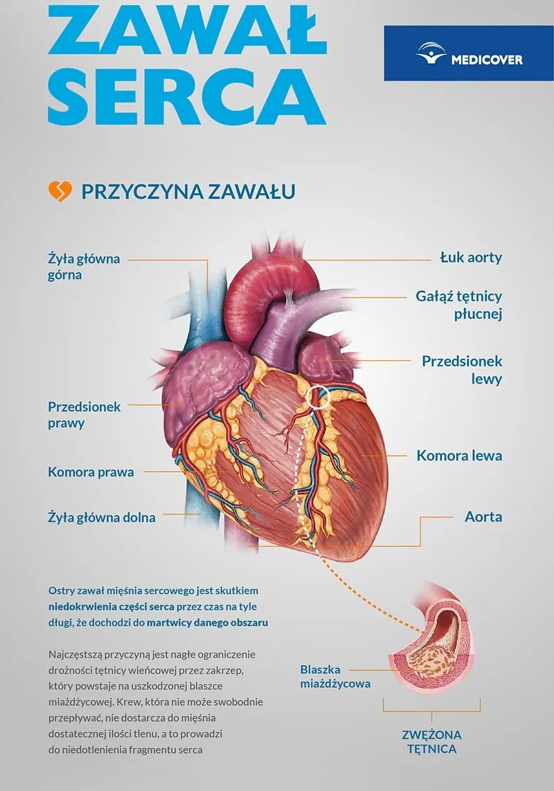 Zdjęcie Bezpieczne leki na przeziębienie po zawale serca - co warto wiedzieć