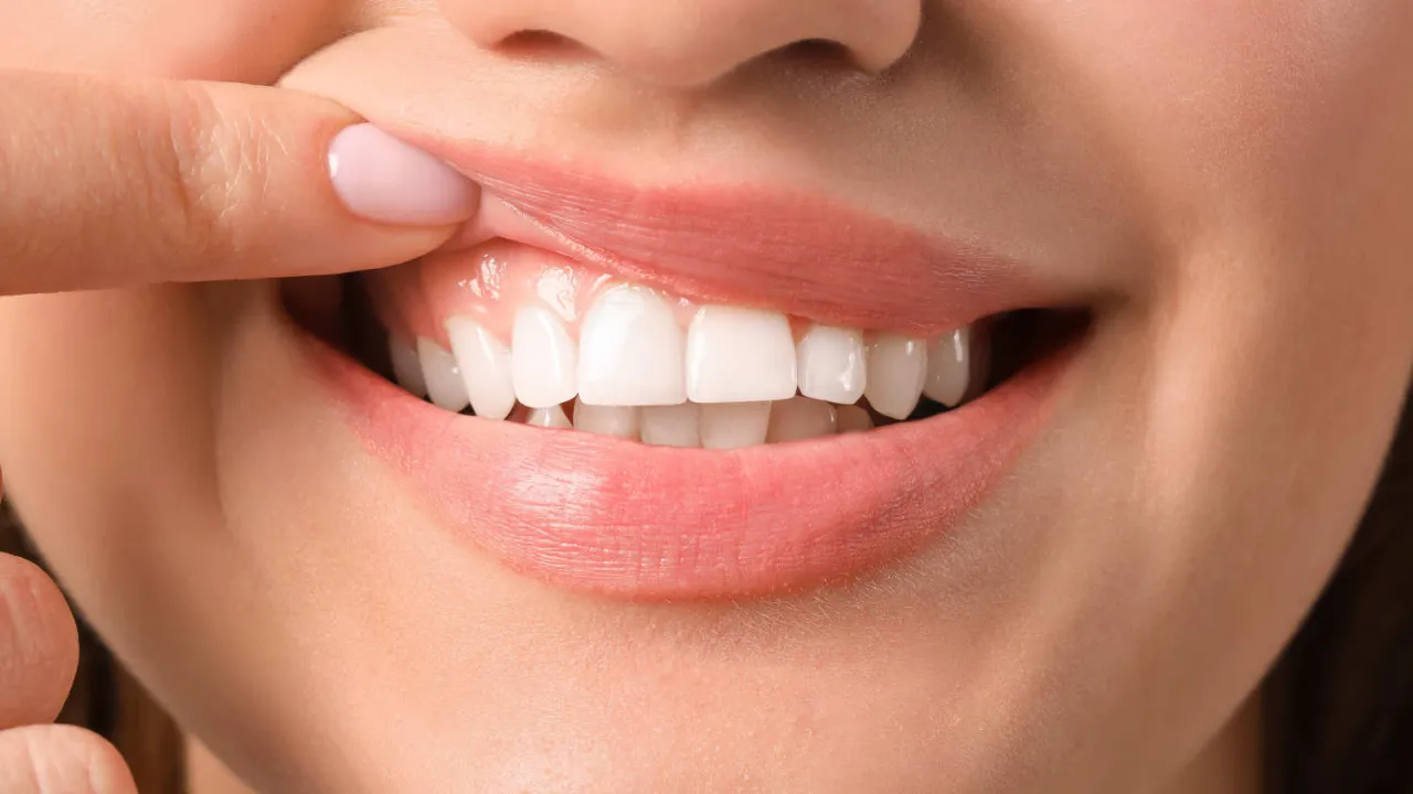 Zdjęcie Zdrowe dziąsła: Jak wyglądają? Sprawdź sw&oacute;j uśmiech!