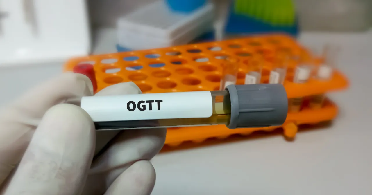 Zdjęcie Jak prawidłowo przygotować się do badania glukozy na czczo i uniknąć błędów