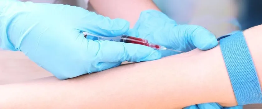 Zdjęcie Dlaczego wątroba nazywana jest laboratorium chemicznym i co to oznacza?