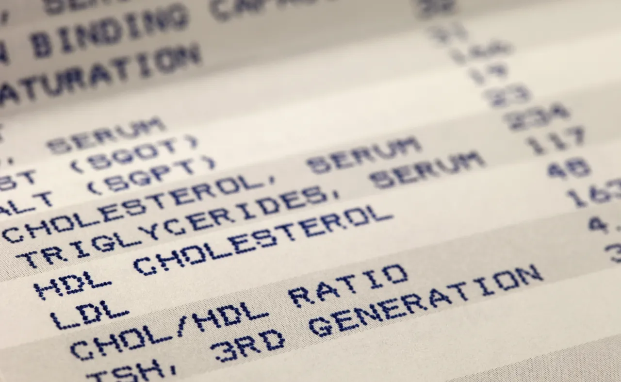 Zdjęcie Czy tabletki na cholesterol odchudzają? Prawda o ich wpływie na wagę