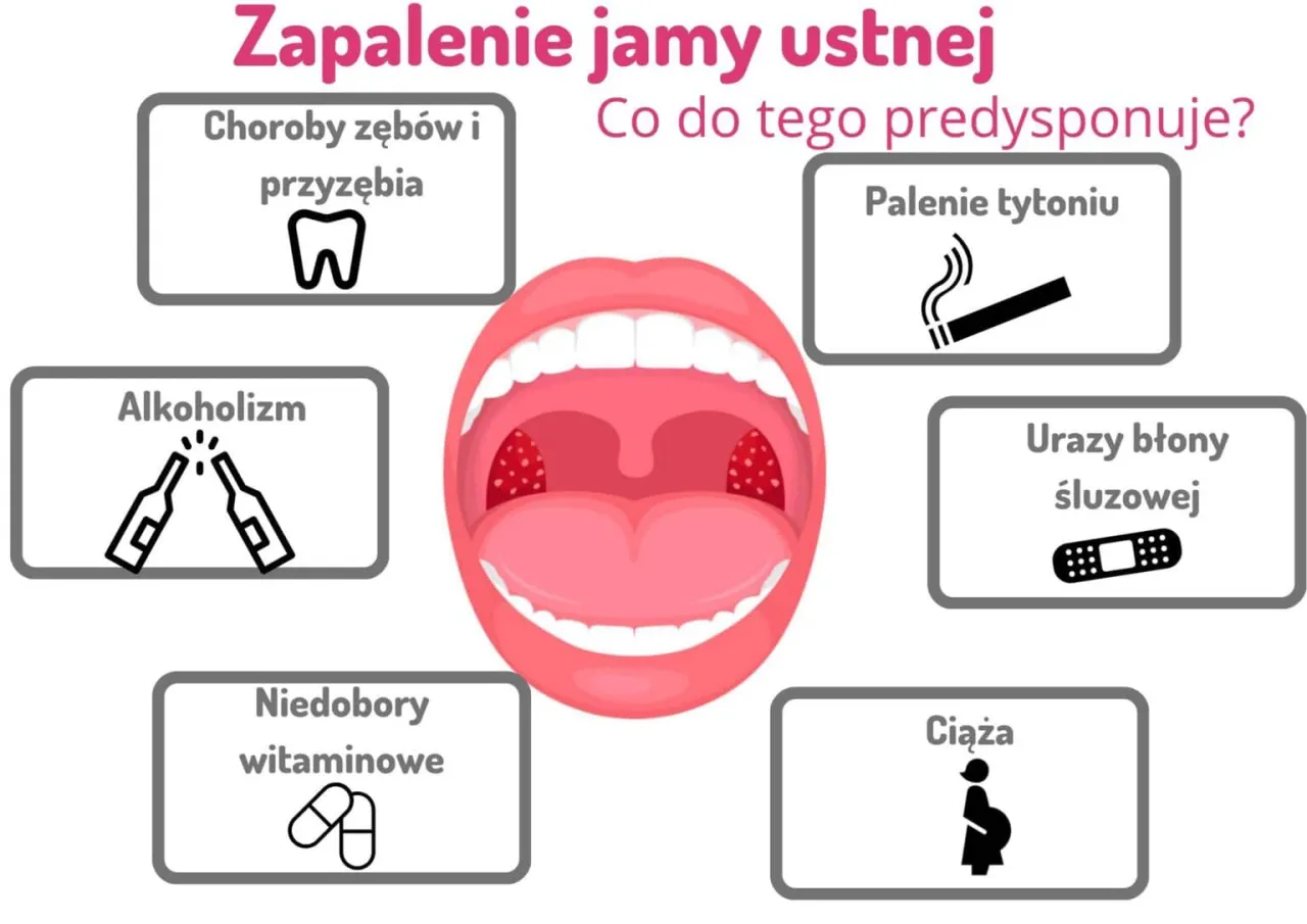 Zdjęcie Objawy infekcji jamy ustnej – jak rozpoznać i uniknąć bólu oraz dyskomfortu