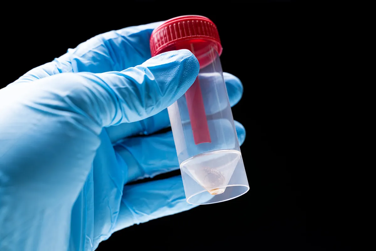 Zdjęcie Gdzie zrobić badania sanitarno-epidemiologiczne i uniknąć problemów zdrowotnych