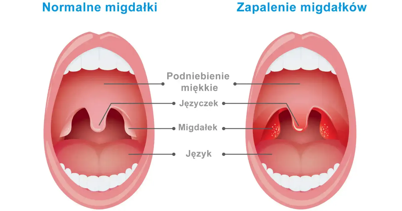 Zdjęcie Czy migdały są zdrowe? 5 niesamowitych korzyści dla Twojego organizmu