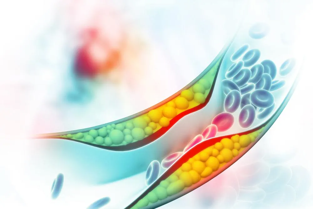 Zdjęcie Jak bezpiecznie podnieść cholesterol? Sprawdź skuteczne metody i porady