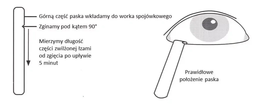 Zdjęcie Jakie badania na jaskrę? Kluczowe testy dla zdrowia oczu