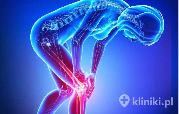Zdjęcie Jakie endoprotezy stawu biodrowego refunduje nfz i co musisz wiedzieć