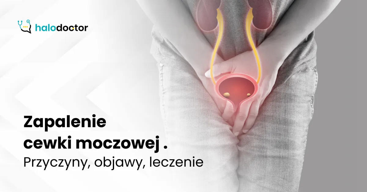 Zdjęcie Zapalenie cewki moczowej – objawy, powikłania i co zrobić w razie ich wystąpienia