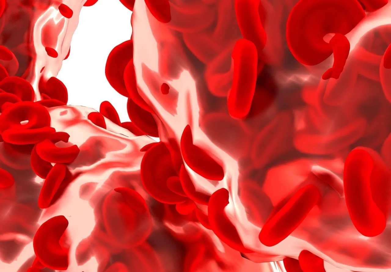 Zdjęcie Podwyższony poziom hemoglobiny: Przyczyny, objawy i skutki dla zdrowia
