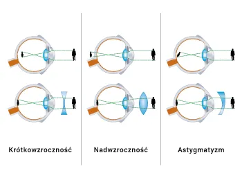 Zdjęcie Od jakiej wady wzroku okulary – kiedy warto zacząć je nosić?