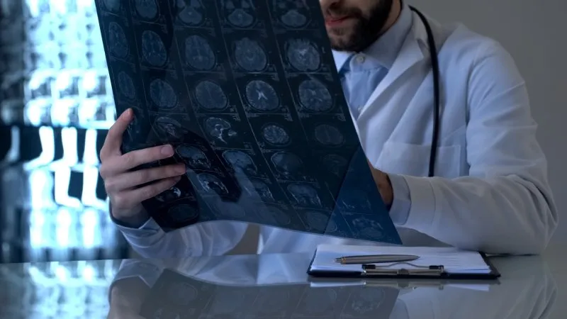 Zdjęcie Jakie badanie na stwardnienie rozsiane? Kluczowe testy diagnostyczne