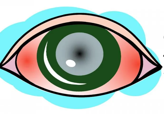 Zdjęcie Co nie wolno przy jaskrze? Unikaj tych szkodliwych działań dla zdrowia oczu