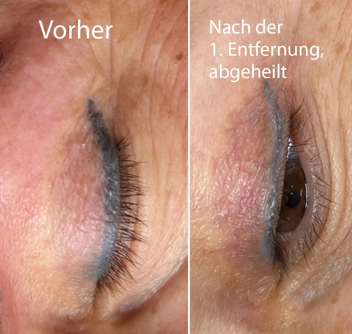 Zdjęcie Risiken von permanentem Make-up Lidstrich: Was Sie wissen sollten