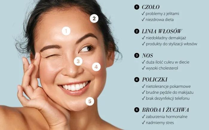 Zdjęcie Skąd się biorą pryszcze? Poznaj przyczyny i skuteczne rozwiązania