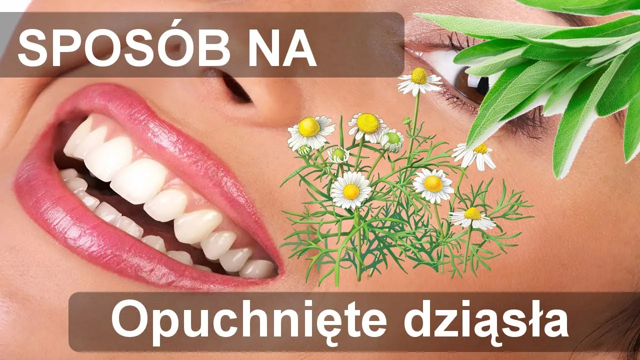 Zdjęcie Skuteczne sposoby na opuchnięte dziąsła – domowe metody i leki bez recepty