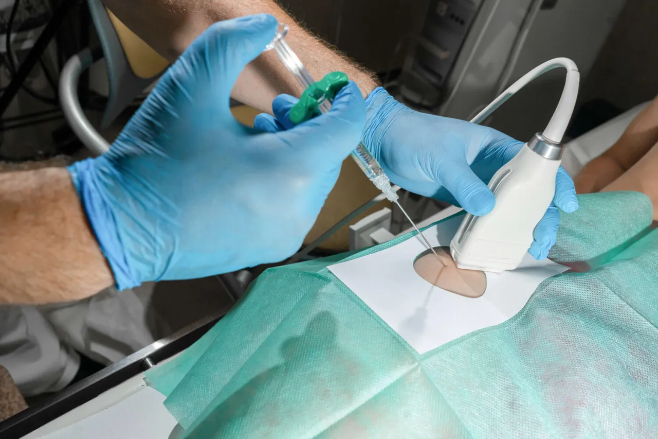 Zdjęcie Leczenie zapalenia stawu krzyżowo-biodrowego: od lek&oacute;w po terapie