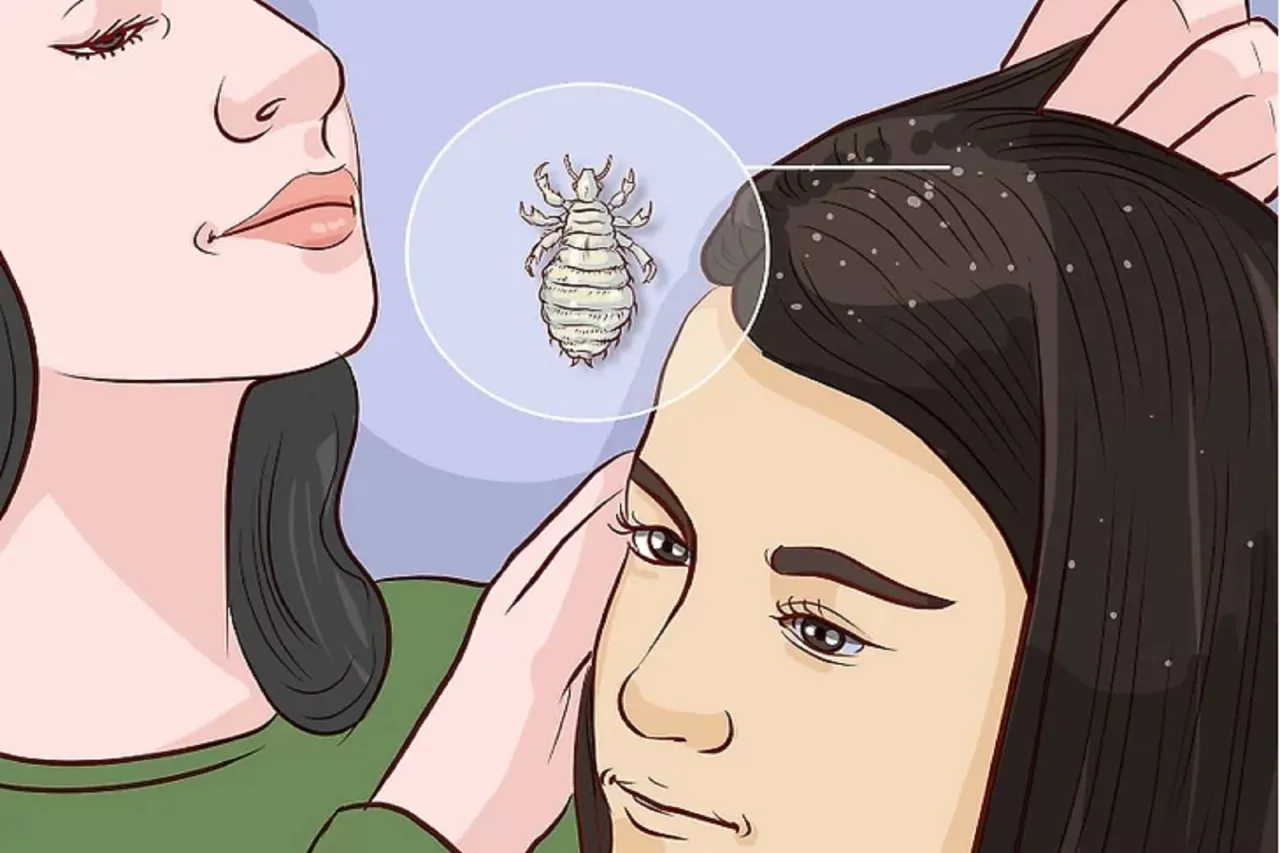 Zdjęcie Jak szybko rozmnażają się wszy i jak temu zapobiec?