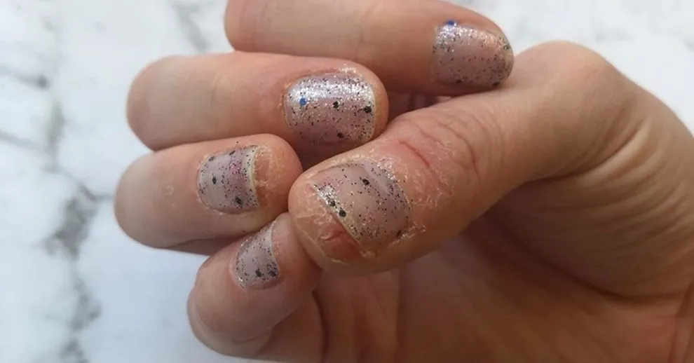 Zdjęcie Czy żel uczula jak hybryda? Sprawdź, zanim użyjesz!