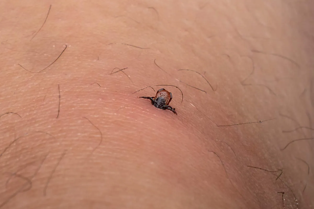 Zdjęcie Czy kleszcz sam odpadnie? Dowiedz się, jak uniknąć zagrożeń zdrowotnych