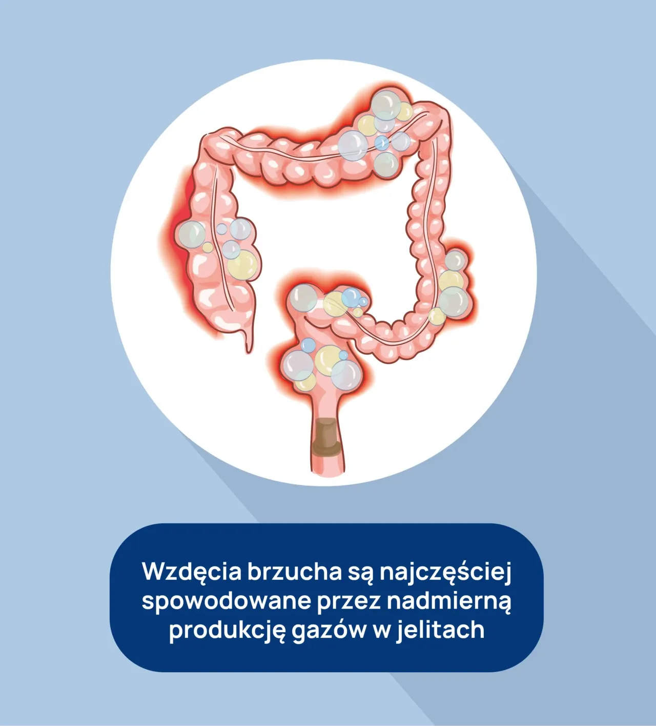 Zdjęcie Ciągłe wzdęcia brzucha przyczyny: co może je powodować i jak je złagodzić
