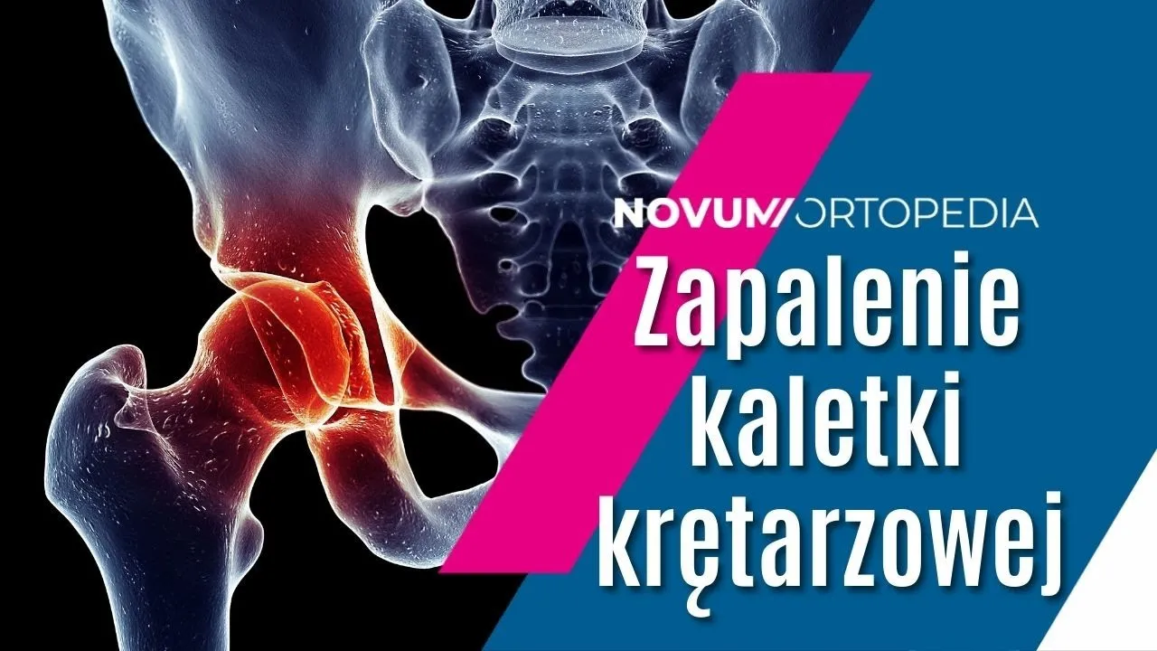 Zdjęcie Skuteczne leki na zapalenie kaletki krętarzowej, które przynoszą ulgę