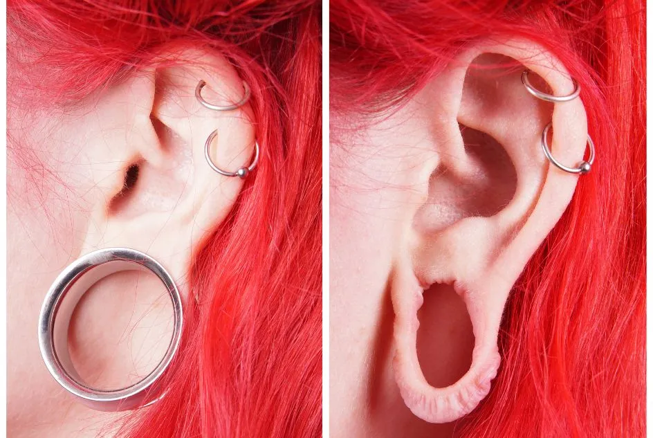 Zdjęcie Jak przemywać kolczyk w uchu, aby uniknąć infekcji i bólu