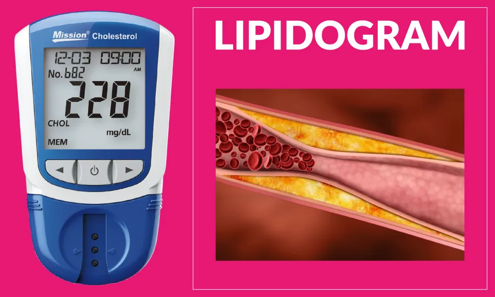 Zdjęcie Badanie cholesterolu na czczo czy po jedzeniu – jak przygotować się prawidłowo?