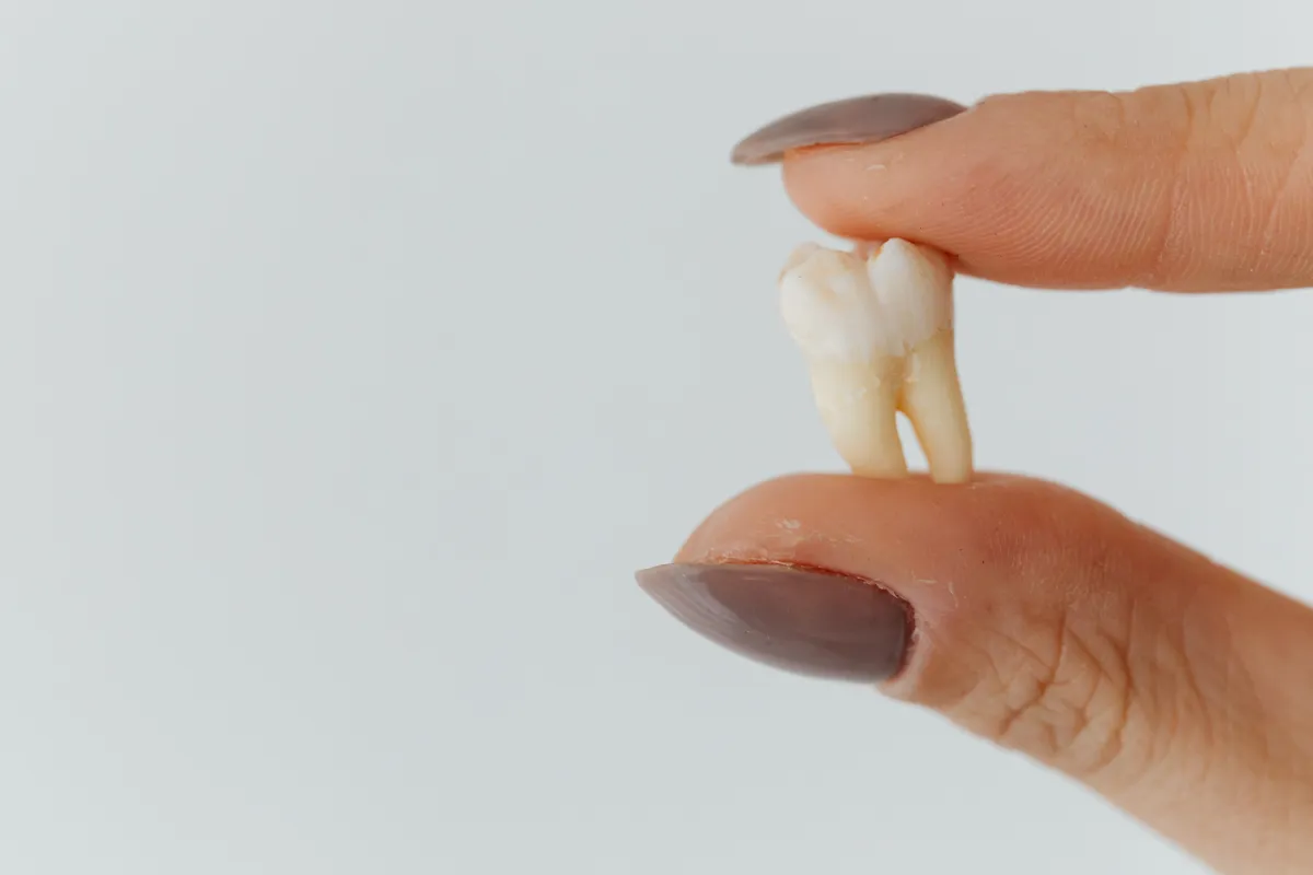Zdjęcie Co dentysta robi z wyrwanym zębem? Ważne informacje o utylizacji