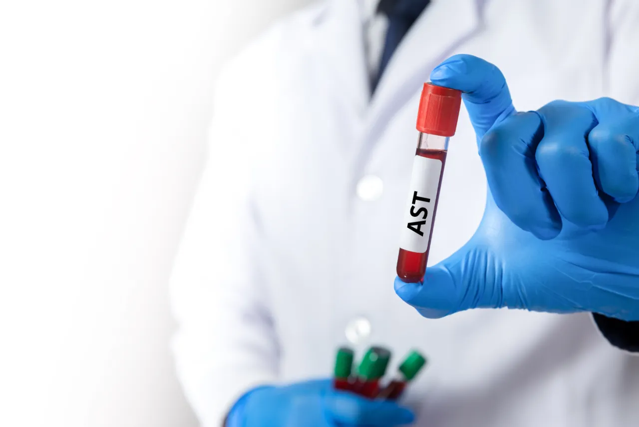 Zdjęcie AST badania co to - kluczowe informacje o zdrowiu wątroby i diagnozie