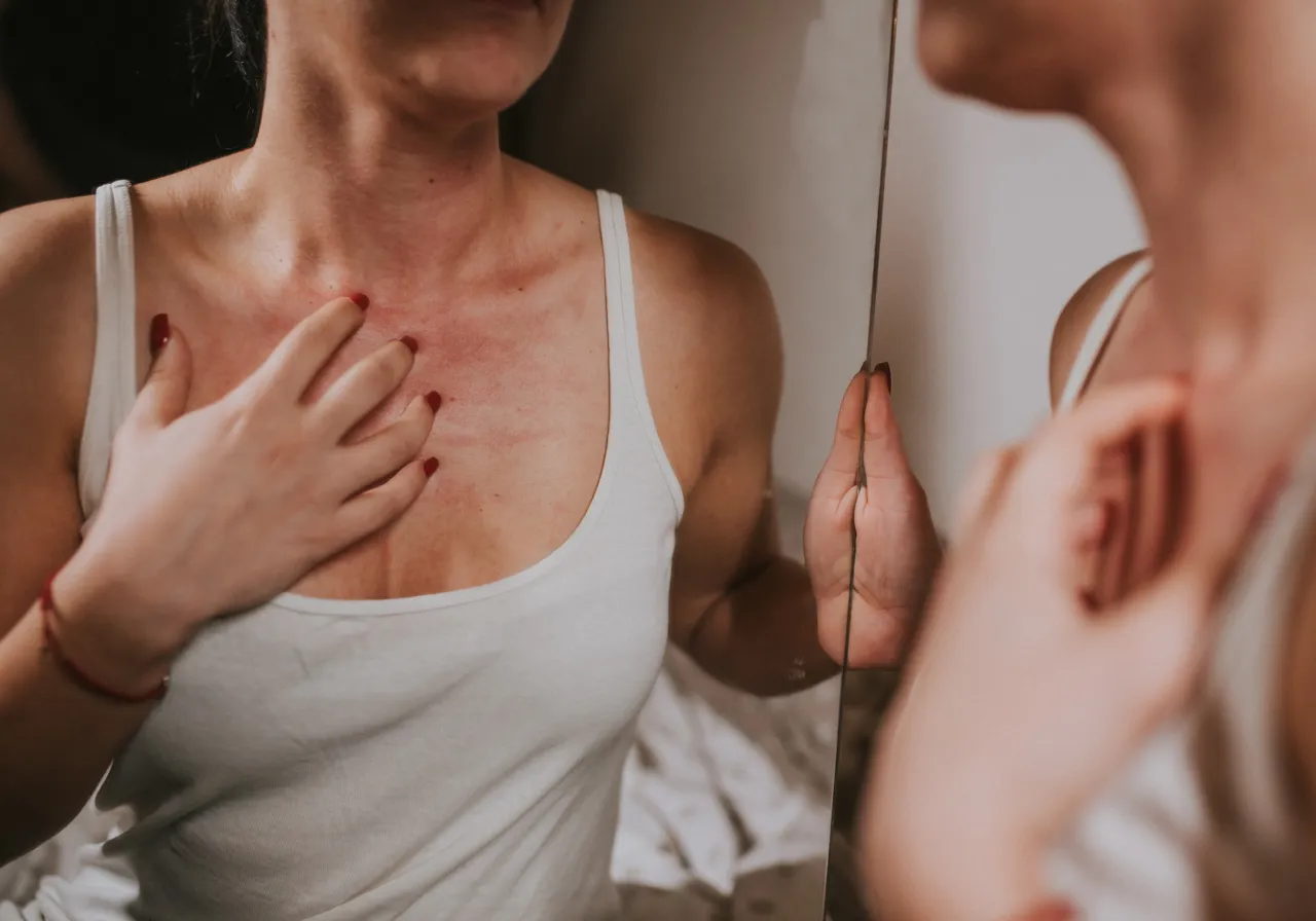 Zdjęcie Jak wygląda uczulenie na perfumy? Objawy, które musisz znać