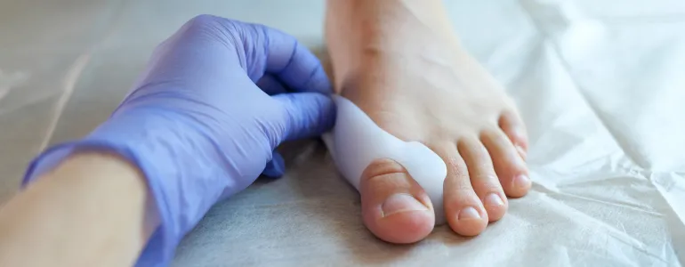 Zdjęcie Haluksy pierwsze objawy – jak je rozpoznać i uniknąć bólu