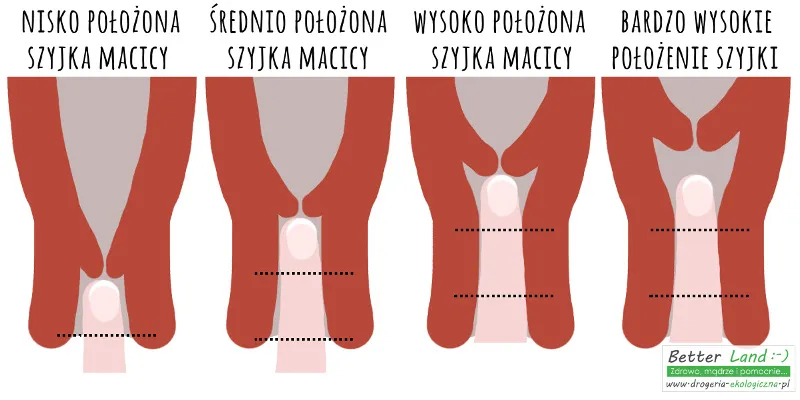 Zdjęcie Jak zmienia się szyjka macicy przed porodem? Kluczowe objawy i porady