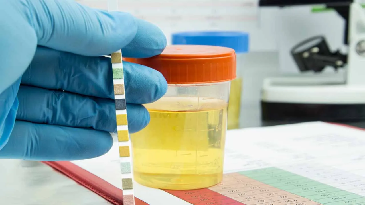 Zdjęcie Síntomas de infección de orina que no debes ignorar para tu salud