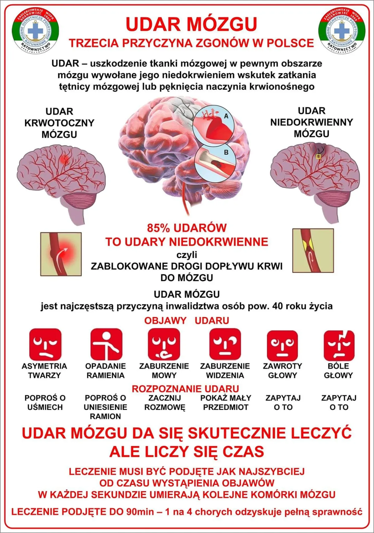 Zdjęcie Kto jest narażony na udar mózgu? Poznaj czynniki ryzyka