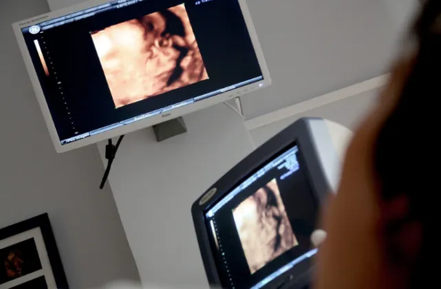 Zdjęcie Czy i kiedy na pogotowiu robią USG? Fakty i mity o badaniach