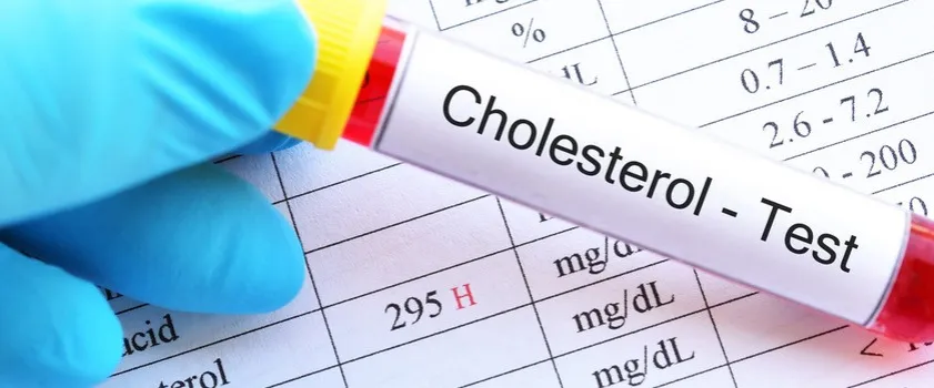 Zdjęcie Jak oznaczony jest cholesterol na wynikach? Zrozum swoje wyniki zdrowotne