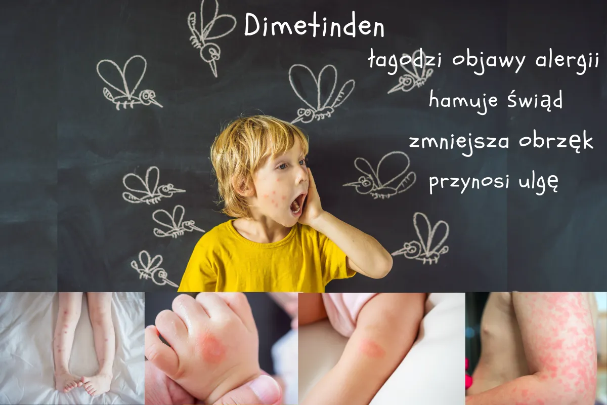 Zdjęcie Jakie leki na wysypkę skutecznie łagodzą objawy i przynoszą ulgę