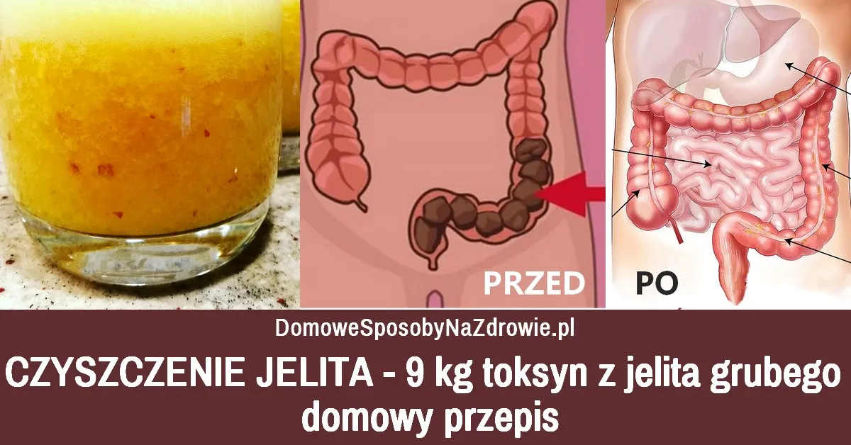 Zdjęcie Skuteczne metody, jak wyczyścić jelita i poprawić zdrowie trawienia