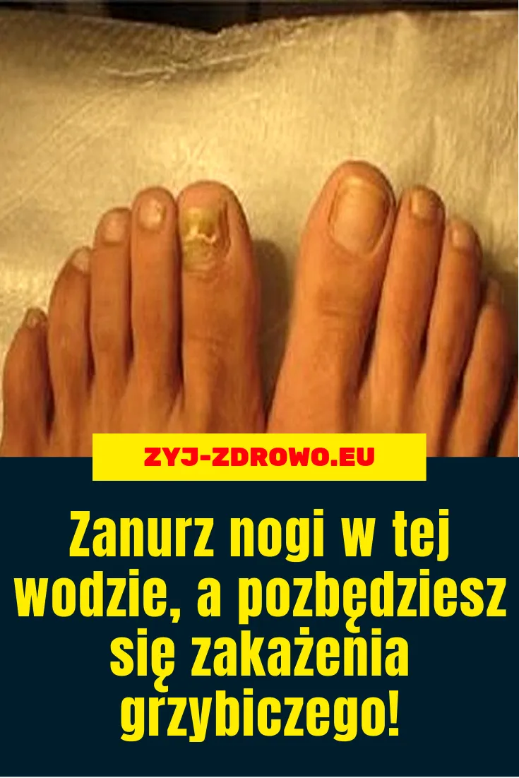 Zdjęcie Skuteczne sposoby na pękające paznokcie u nóg - domowe kuracje