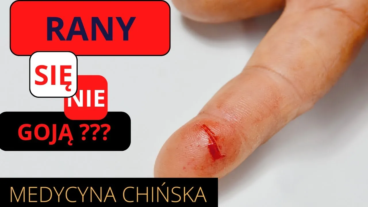 Zdjęcie Jak przyspieszyć gojenie piercingu i uniknąć bolesnych komplikacji – praktyczne porady