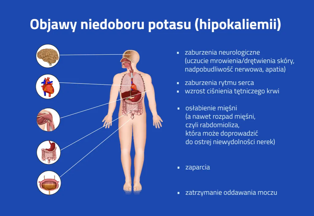 Zdjęcie Podwyższony poziom potasu: przyczyny i skuteczne metody leczenia