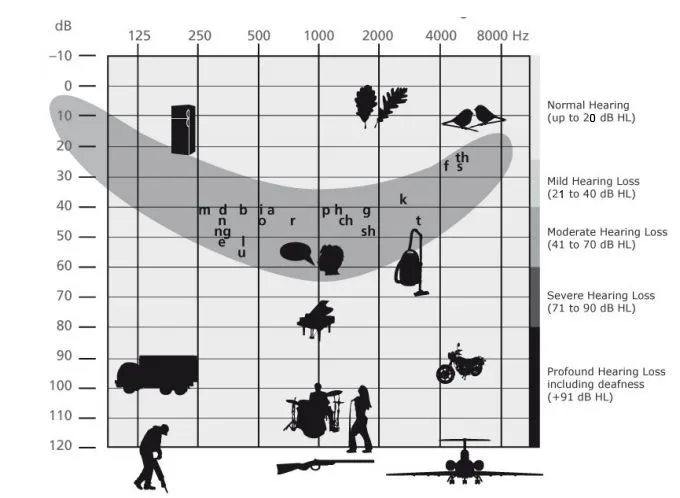 Zdjęcie Audiogram - jak wygląda badanie słuchu i ile faktycznie trwa u specjalisty