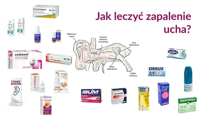 Zdjęcie Skuteczne sposoby na ból ucha – domowe metody i leki bez recepty