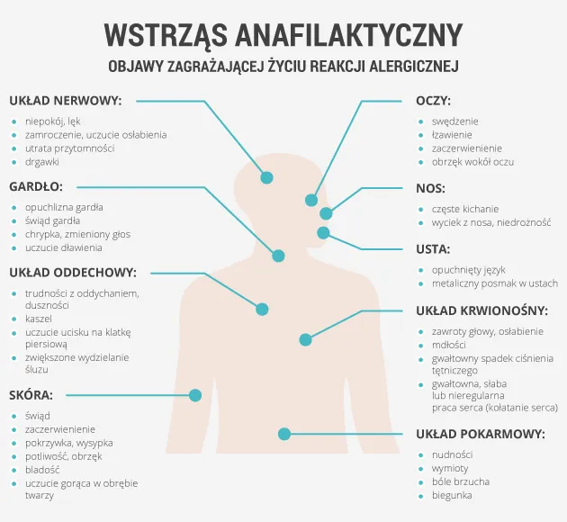 Objawy wstrząsu anafilaktycznego